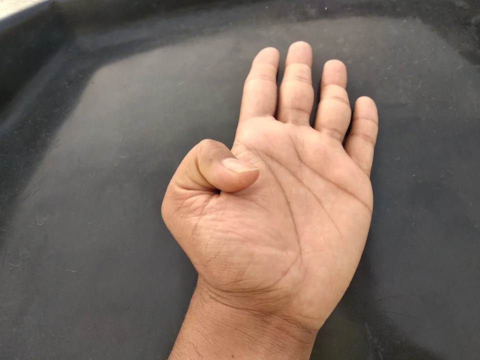 A hand displaying hitchhiker's thumb, resting on a dark surface with fingers slightly spread