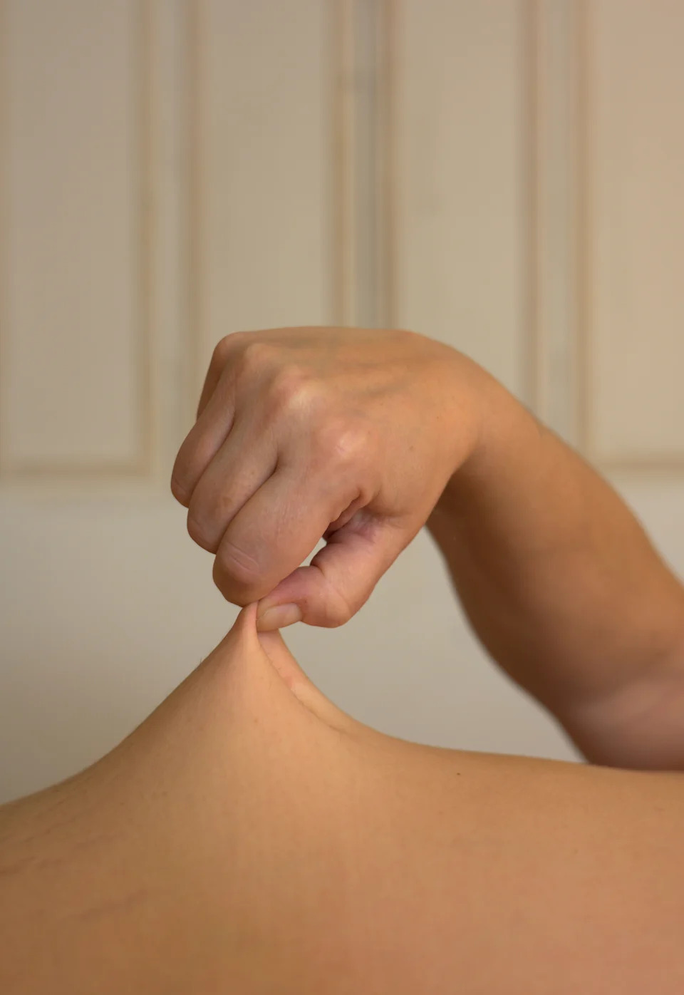 Person pinching a small section of their skin between two fingers, likely demonstrating a skincare or health concept