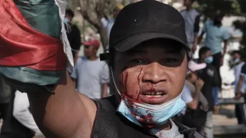 EPA / Shutterstock An injured man bleeds during an anti-government protest in Antananarivo, Madagascar, 11 October 2025