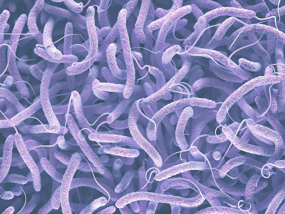 Close-up view of spiral-shaped bacteria with tail-like structures, resembling a dense collection of tiny worms or strands